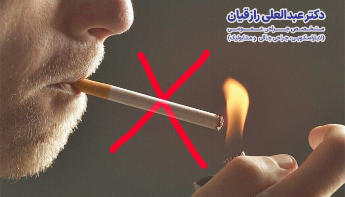 آمادگی های لازم قبل از جراحی اسلیو معده