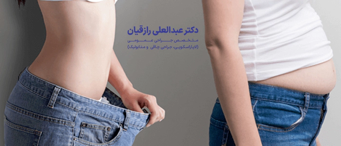 بای پس معده تا چه حد وزن را کم می‌کند؟