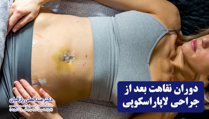 دوران نقاهت جراحی لاپاراسکوپی چقدر است؟