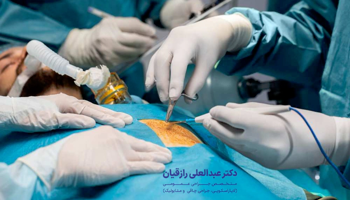 عمل کیسه صفرا چقدر طول میکشد؟