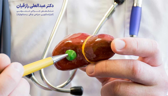 مراقبت های بلافاصله بعد از ترخیص از بیمارستان برای عمل کیسه صفرا