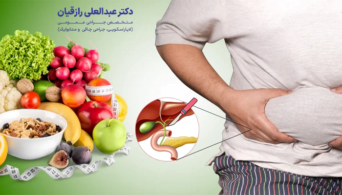 مراقبت های غذایی مناسب بعد از عمل کیسه صفرا چیست؟
