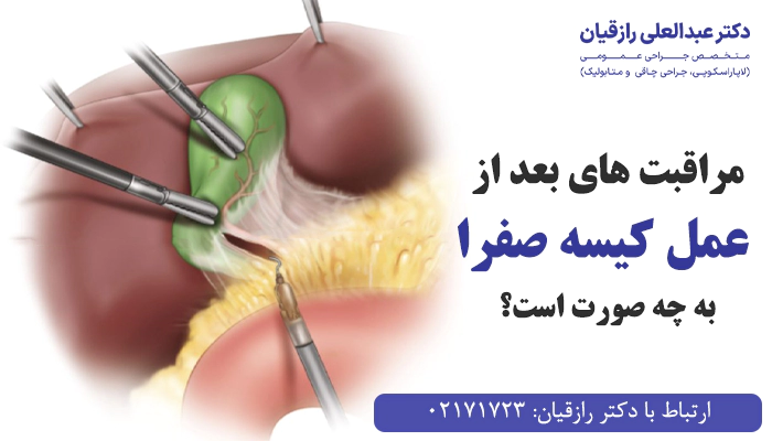 چگونه مراقبت های بعد از عمل کیسه صفرا را انجام دهیم؟