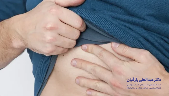 عوارض احتمالی جراحی فتق شکم