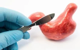 بهترین جراح اسلیو معده چه کسی است؟ - دکتر عبدالعلی رازقیان